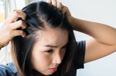 Corte de cabelo 'chavoso' em mulher choca por simular efeitos da calvície